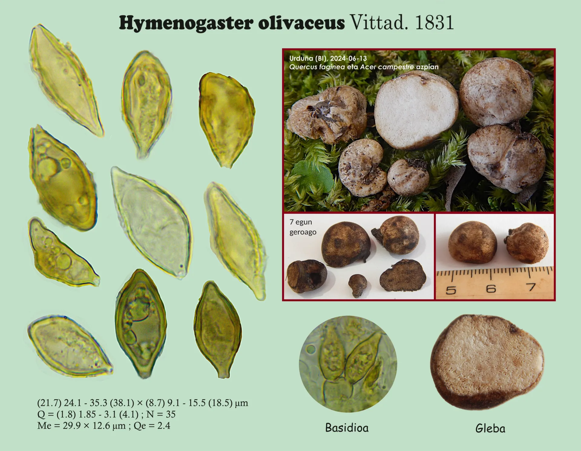 Microscopía de Hymenogaster olivaceus